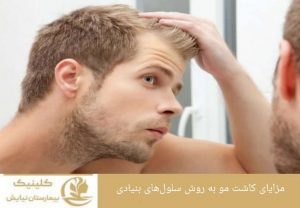 مزایای کاشت مو به روش سلول‌های بنیادی