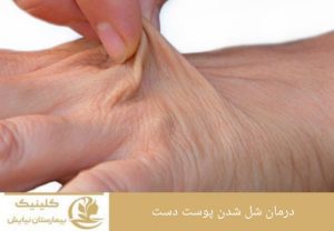 درمان شل شدن پوست دست