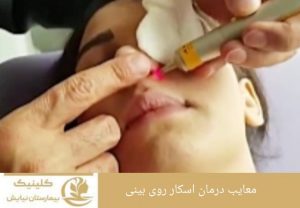 معایب درمان اسکار روی بینی