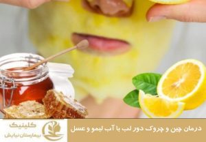 درمان چین و چروک دور لب با آب لیمو و عسل
