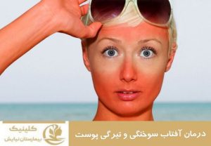 درمان آفتاب سوختگی و تیرگی پوست