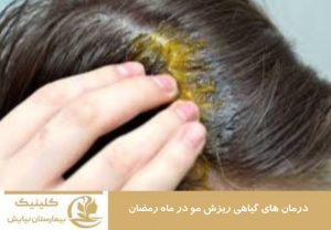 درمان های گیاهی ریزش مو در ماه رمضان