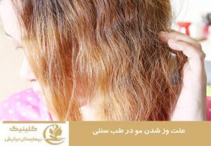 علت وز شدن مو در طب سنتی