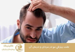 علت ریزش مو در مردان ودرمان آن