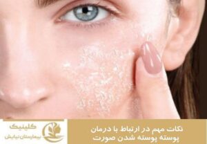 نکات مهم در ارتباط با درمان پوسته پوسته شدن صورت