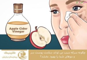 چگونه سرکه سیب می تواند سلامت پوست سر و موهای شما را بهبود بخشد ؟