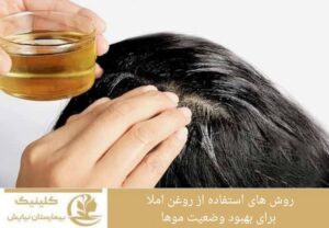 روش‌های استفاده از روغن آملا برای بهبود وضعیت موها