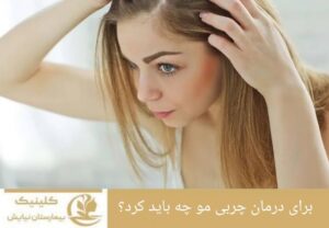 برای درمان چربی مو چه باید کرد؟