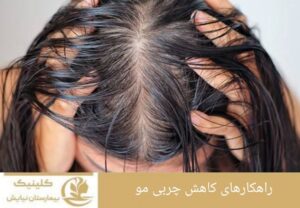 راهکارهای کاهش چربی مو