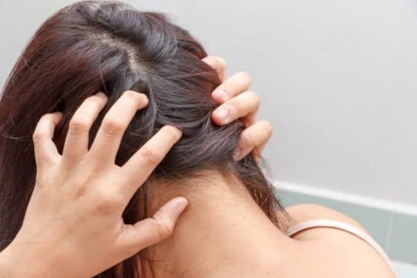 برای درمان چربی مو چه باید کرد؟