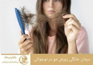 درمان خانگی ریزش مو در نوجوانی