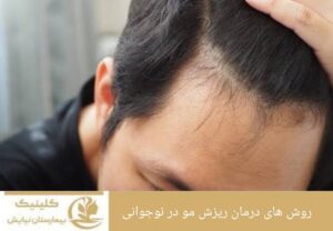 روش‌های درمان ریزش مو در نوجوانی