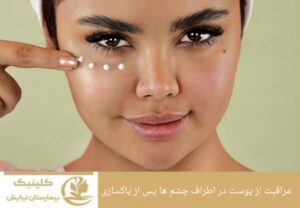 مراقبت از پوست در اطراف چشم‌ها پس از پاکسازی