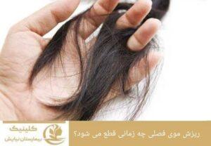 ریزش موی فصلی چه زمانی قطع می شود؟