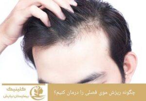 چگونه ریزش موی فصلی را درمان کنیم؟