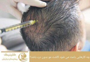 چه کارهایی باعث می شود کاشت مو بدون درد باشد؟