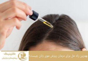 بهترین راه حل برای درمان ریزش موی زنان چیست؟