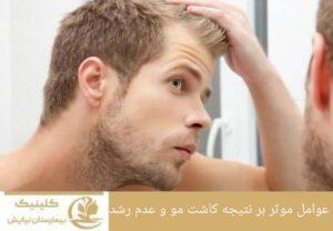 عوامل موثر بر نتیجه کاشت مو و عدم رشد