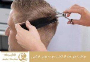 مراقبتهای بعد از کاشت مو به روش ترکیبی