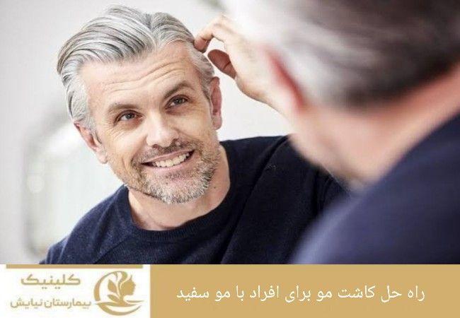 راه حل کاشت مو برای افرادی با مو سفید