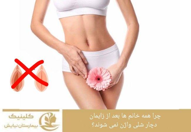 لابیاپلاستی