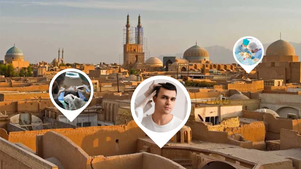 بهترین کلینیک کاشت مو در یزد